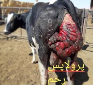 پرولاپس رحمی
