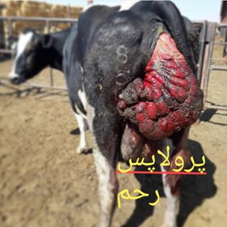 پرولاپس رحمی